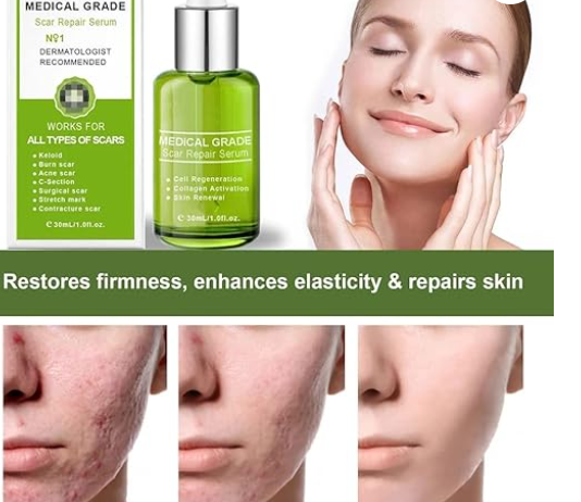 Scar Repair Essence Advanced Scar Gel (30 ml, Pack of 1)